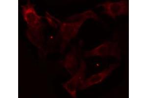 ABIN6274658 staining Hela cells by IF/ICC. (CYP3A4 抗体)