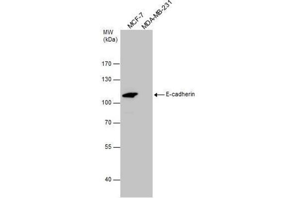 E-cadherin 抗体