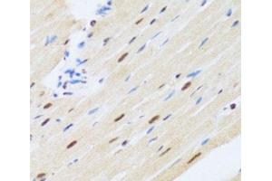 Immunohistochemistry of paraffin-embedded Rat heart using MTA3 Polyclonal Antibody at dilution of 1:100 (40x lens). (MTA3 抗体)