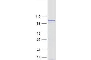 Western Blotting (WB) image for Component of Oligomeric Golgi Complex 7 (COG7) protein (Myc-DYKDDDDK Tag) (ABIN2712951)