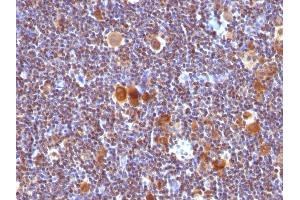 Formalin-fixed, paraffin-embedded human Hodgkin's Lymphoma stained with Bax Monoclonal Antibody (Clone SPM33). (BAX 抗体  (AA 3-16))