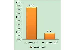 Immunohistochemistry analysis of paraffin-embedded human brain tissue using EPHA3/4/5 (Phospho-Tyr779/833) antibody. (EPH Receptor A3 抗体  (pTyr779, pTyr833))