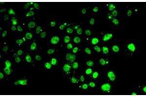 Immunofluorescence analysis of MCF7 cells using GABPB1 Polyclonal Antibody (GABPB1 抗体)