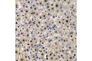 Immunohistochemistry of paraffin-embedded rat liver using KPNA4 Antibody (ABIN5971058) at dilution of 1/100 (40x lens). (KPNA4 抗体)