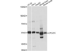 Western blot analysis of extracts of various cell lines, using LPCAT4 antibody (ABIN6292470) at 1:3000 dilution. (LPCAT4 抗体)