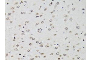 Immunohistochemistry of paraffin-embedded mouse brain using TMPO Antibody (ABIN1875122) at dilution of 1:100 (40x lens). (Thymopoietin 抗体)