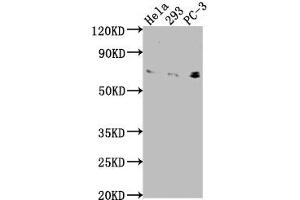 Western Blot Positive WB detected in: Hela whole cell lysate, 293 whole cell lysate, PC-3 whole cell lysate All lanes: EXOC7 antibody at 1:2000 Secondary Goat polyclonal to rabbit IgG at 1/50000 dilution Predicted band size: 84, 79, 75, 33, 78, 81 kDa Observed band size: 75 kDa (EXOC7 抗体  (AA 521-735))