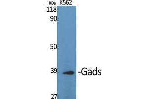 Western Blot (WB) analysis of specific cells using Gads Polyclonal Antibody.