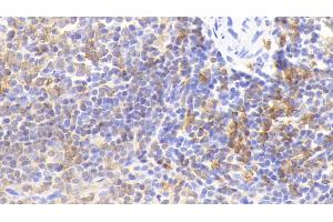 Detection of HLA-DRA in Rabbit Spleen Tissue using Polyclonal Antibody to HLA Class II Histocompatibility Antigen, DR Alpha Chain (HLA-DRA) (HLA-DRA 抗体  (AA 26-221))