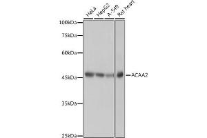 Western blot analysis of extracts of various cell lines, using  antibody (ABIN7265367) at 1:1000 dilution. (ACAA2 抗体)