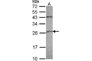 WB Image Sample (30 ug of whole cell lysate) A: 293T 12% SDS PAGE GST A4 antibody antibody diluted at 1:1000 (GSTA4 抗体)