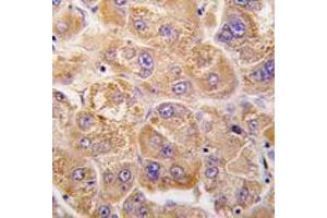 Image no. 1 for anti-Insulin-Degrading Enzyme (IDE) (Center) antibody (ABIN356957) (IDE 抗体  (Center))