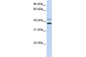 WB Suggested Anti-MKRN2 Antibody Titration:  0. (MKRN2 抗体  (N-Term))