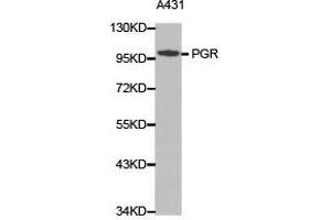 Western Blotting (WB) image for anti-Progesterone Receptor (PGR) antibody (ABIN1874114) (Progesterone Receptor 抗体)