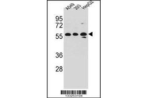 Western blot analysis in A549,293,HepG2 cell line lysates (35ug/lane). (TRIM4 抗体  (N-Term))