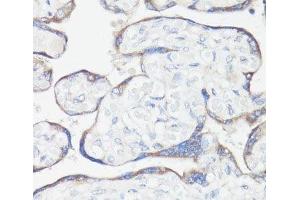 Immunohistochemistry of paraffin-embedded Human placenta using CLUH Polyclonal Antibody at dilution of 1:100 (40x lens). (CLUH 抗体)