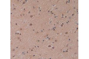Used in DAB staining on fromalin fixed paraffin- embedded brain tissue (CBY1/PGEA1 抗体  (AA 12-115))