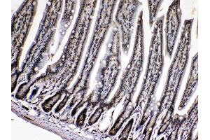 Immunohistochemistry (IHC) image for anti-Peptidylprolyl Isomerase A (Cyclophilin A) (PPIA) (AA 116-165) antibody (ABIN5518864)