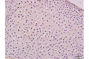 Formalin-fixed and paraffin embedded mouse embryo tissue labeled with Anti Apg12 Polyclonal Antibody,Unconjugated (ABIN752518) at 1:200 followed by conjugation to the secondary antibody and DAB staining. (ATG12 抗体  (AA 101-187))