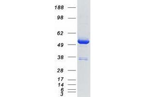 Validation with Western Blot