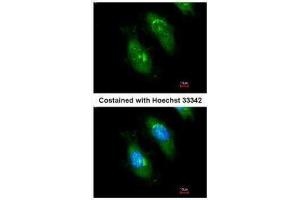 ICC/IF Image Immunofluorescence analysis of methanol-fixed HeLa, using SMN1, antibody at 1:200 dilution. (SMN1 抗体)