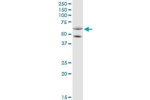 Western Blotting (WB) image for anti-Cytochrome P450, Family 11, Subfamily A, Polypeptide 1 (CYP11A1) (AA 1-521) antibody (ABIN514847)