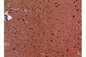 Immunohistochemistry (IHC) image for anti-Heat Shock Protein 90 (HSP90) (Lys284), (Lys292) antibody (ABIN3187840)