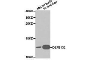 Western Blotting (WB) image for anti-Defensin, beta 132 (DEFB132) antibody (ABIN1872246) (DEFB132 抗体)