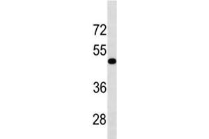 TGFBR1 antibody western blot analysis in human HL-60 lysate. (TGFBR1 抗体  (AA 145-172))