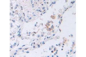 Used in DAB staining on fromalin fixed paraffin- embedded lung tissue (TAP2 抗体  (AA 468-686))