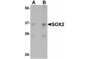 Image no. 1 for anti-SRY (Sex Determining Region Y)-Box 2 (SOX2) (N-Term) antibody (ABIN478109) (SOX2 抗体  (N-Term))