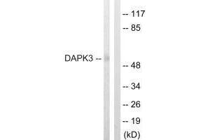 Western blot analysis of extracts from HuvEc cells, using DAPK3 (Ab-265) antibody. (DAPK3 抗体  (Thr265))