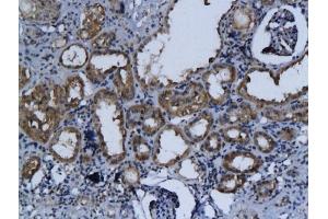 Formalin-fixed and paraffin embedded rat kidney labeled with Anti-Talin Polyclonal Antibody, Unconjugated (ABIN701695) followed by conjugation to the secondary antibody and DAB staining (TLN1 抗体  (AA 1601-1750))