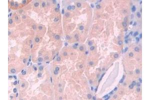 Detection of LCAT in Human Kidney Tissue using Polyclonal Antibody to Lecithin Cholesterol Acyltransferase (LCAT) (LCAT 抗体  (AA 290-433))