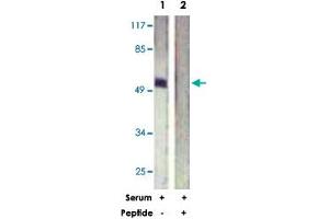 Western blot analysis of extracts from HeLa cells, treated with Serum (20 %, 15 mins), using ETS1 polyclonal antibody . (ETS1 抗体)