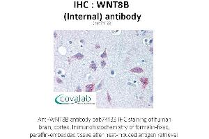 Image no. 2 for anti-Wingless-Type MMTV Integration Site Family, Member 8B (WNT8B) (Internal Region) antibody (ABIN1740842) (WNT8B 抗体  (Internal Region))