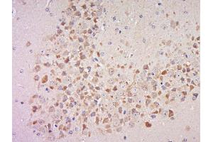 Paraformaldehyde-fixed, paraffin embedded mouse brain, Antigen retrieval by boiling in sodium citrate buffer (pH6) for 15min, Block endogenous peroxidase by 3% hydrogen peroxide for 30 minutes, Blocking buffer (normal goat serum) at 37°C for 20min, Antibody incubation with Rabbit Anti-MSK1 (Ser360) Polyclonal Antibody, Unconjugated  at 1:500 overnight at 4°C, followed by a conjugated secondary for 90 minutes and DAB staining. (MSK1 抗体  (pSer360))