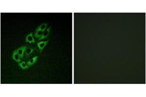Immunofluorescence analysis of A549 cells, using MtSSB Antibody. (SSBP1 抗体  (AA 99-148))