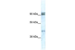 Western Blot showing ZNF227 antibody used at a concentration of 1-2 ug/ml to detect its target protein. (ZNF227 抗体  (N-Term))