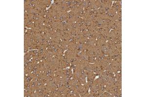 IHC analysis of SEC31A using anti-SEC31A antibody (ABIN7599630).