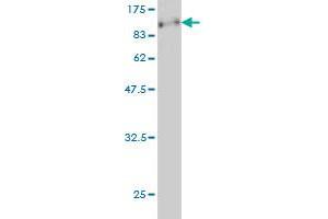 Western Blot detection against Immunogen (89. (CDKN2AIP 抗体  (AA 1-579))