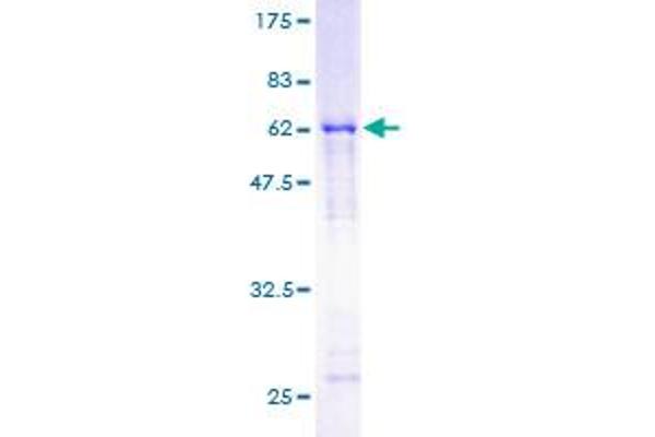 SET/TAF-I Protein (AA 1-277) (GST tag)