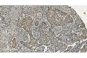 IHC analysis of U2AF65/U2AF2 using anti U2AF65/U2AF2 antibody (ABIN7600795). (U2AF2 抗体  (AA 238-470))