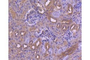 Paraformaldehyde-fixed, paraffin embedded human kidney tissue, Antigen retrieval by boiling in sodium citrate buffer (pH6) for 15min, Block endogenous peroxidase by 3% hydrogen peroxide for 30 minutes, Blocking buffer (normal serum) at 37°C for 20min, Antibody incubation with IRF6 (1A1) Monoclonal Antibody  at 1:50 overnight at 4°C, followed by a conjugated secondary and DAB staining. (IRF6 抗体)