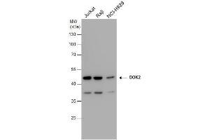 WB Image DOK2 antibody detects DOK2 protein by western blot analysis. (DOK2 抗体)