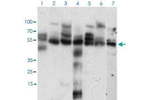Western blot analysis of Lane 1: Hela cell lysate; Lane 2: K562 cell lysate; Lane 3: NIH/3T3 cell lysate; Lane 4: C6 cell lysate; Lane 5: MCF-7 cell lysate; Lane 6: Jurkat cell lysate; Lane 7: A431 cell lysate with CCNE1 monoclonal antibody, clone 5F8C5  at 1:500-1:2000 dilution.