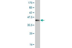 Western Blot detection against Immunogen (36. (Mesothelin 抗体  (AA 464-563))