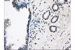 Immunohistochemical staining of paraffin-embedded Ovary tissue using anti-FCGR2A mouse monoclonal antibody. (FCGR2A 抗体)