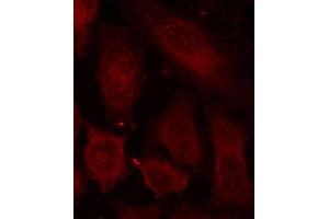 Immunofluorescence staining of methanol-fixed HeLa cells using Phospho-DOK2-Y299 antibody (ABIN2987731). (DOK2 抗体  (pTyr299))