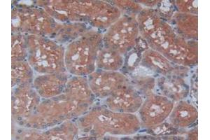 Figure. (Maltase-Glucoamylase (MGAM) (AA 213-392) 抗体)